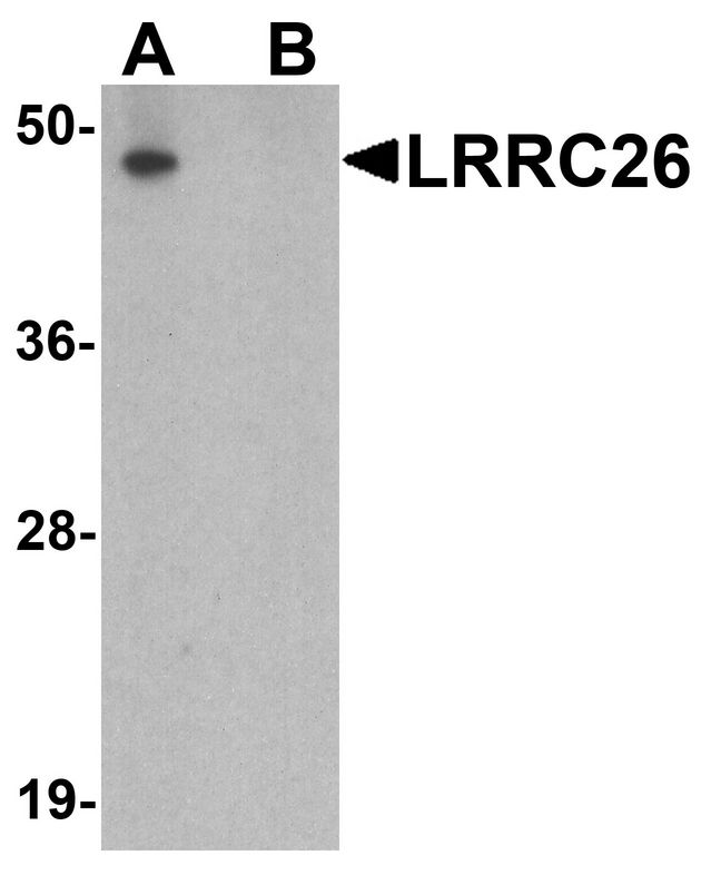LRRC26 Antibody - Western blot analysis of LRRC26 in human prostate tissue lysate with LRRC26 antibody at 0.5 ug/ml in (A) the absence and (B) the presence of blocking peptide.