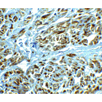 LRRC26 Antibody - Immunohistochemistry of LRRC26 in human prostate tissue with LRRC26 antibody at 2.5 µg/ml.