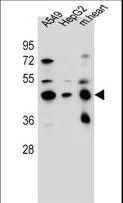 LRRC28 Antibody - LRRC28 Antibody western blot of A549,HepG2 cell line and mouse heart tissue lysates (35 ug/lane). The LRRC28 antibody detected the LRRC28 protein (arrow).