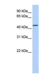 LRRC28 Antibody - LRRC28 antibody Western blot of Jurkat lysate. This image was taken for the unconjugated form of this product. Other forms have not been tested.