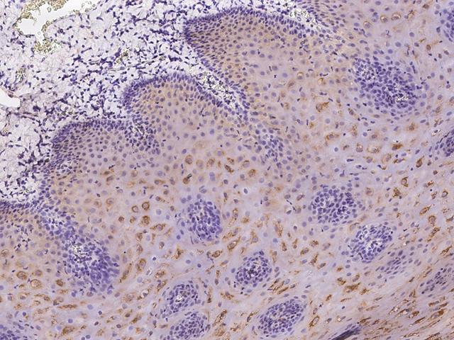 LRRC29 Antibody - Immunochemical staining of human LRRC29 in human esophagus with rabbit polyclonal antibody at 1:200 dilution, formalin-fixed paraffin embedded sections.