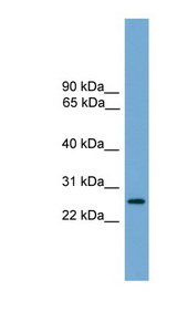 LRRC3 Antibody - LRRC3 antibody Western blot of Fetal Brain lysate. This image was taken for the unconjugated form of this product. Other forms have not been tested.