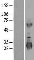 LRRC3 Protein - Western validation with an anti-DDK antibody * L: Control HEK293 lysate R: Over-expression lysate