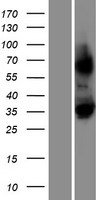 LRRC30 Protein - Western validation with an anti-DDK antibody * L: Control HEK293 lysate R: Over-expression lysate