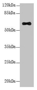 LRRC31 Antibody - Western Blot All lanes: LRRC31 antibody at 5µg/ml + Mouse small intestine tissue Secondary Goat polyclonal to rabbit IgG at 1/10000 dilution Predicted band size: 62, 56, 39, 49 kDa Observed band size: 62 kDa