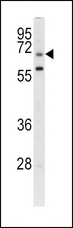 LRRC32 Antibody - Western blot of GARP antibody in CEM cell line lysates (35 ug/lane). GARP (arrow) was detected using the purified antibody.
