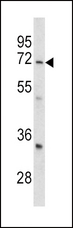 LRRC32 Antibody - Western blot of GARP antibody in mouse cerebellum tissue lysates (35 ug/lane). GARP (arrow) was detected using the purified antibody.