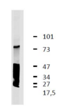 LRRC32 Antibody - Western Blotting analysis (reducing conditions) of GARP antigen and its degradatory products in lysate of human thrombocytes by anti-GARP monoclonal antibody (GARP5).
