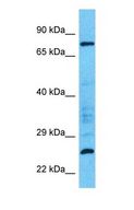 LRRC36 Antibody - Western blot of LRRC36 Antibody with human HT1080 Whole Cell lysate.  This image was taken for the unconjugated form of this product. Other forms have not been tested.