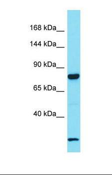 LRRC37A Antibody - Western blot of Human Fetal Lung. LRRC37A antibody dilution 1.0 ug/ml.  This image was taken for the unconjugated form of this product. Other forms have not been tested.