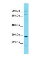 LRRC38 Antibody - Western blot of Placenta. LRRC38 antibody dilution 1.0 ug/ml.  This image was taken for the unconjugated form of this product. Other forms have not been tested.