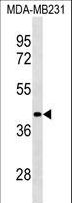 LRRC39 Antibody - LRRC39 Antibody western blot of MDA-MB231 cell line lysates (35 ug/lane). The LRRC39 antibody detected the LRRC39 protein (arrow).