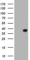 LRRC39 Antibody - HEK293T cells were transfected with the pCMV6-ENTRY control (Left lane) or pCMV6-ENTRY LRRC39 (Right lane) cDNA for 48 hrs and lysed. Equivalent amounts of cell lysates (5 ug per lane) were separated by SDS-PAGE and immunoblotted with anti-LRRC39.