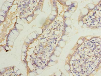 LRRC39 Antibody - Immunohistochemistry of paraffin-embedded human small intestine tissue using antibody at dilution of 1:100.