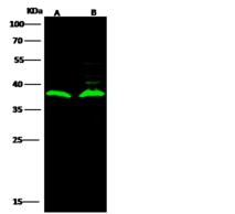 LRRC3B Antibody - Anti-LRRC3B rabbit polyclonal antibody at 1:500 dilution. Lane A: A549 Whole Cell Lysate. Lane B: HEK293 Whole Cell Lysate. Lysates/proteins at 30 ug per lane. Secondary: Goat Anti-Rabbit IgG H&L (Dylight800) at 1/10000 dilution. Developed using the Odyssey technique. Performed under reducing conditions. Predicted band size: 29 kDa. Observed band size: 38 kDa.