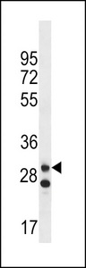 LRRC3C Antibody - LRRC3C Antibody western blot of MDA-MB231 cell line lysates (35 ug/lane). The LRRC3C antibody detected the LRRC3C protein (arrow).