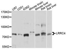 LRRC4 Antibody - Western blot analysis of extracts of various cell lines, using LRRC4 antibody at 1:1000 dilution. The secondary antibody used was an HRP Goat Anti-Rabbit IgG (H+L) at 1:10000 dilution. Lysates were loaded 25ug per lane and 3% nonfat dry milk in TBST was used for blocking. An ECL Kit was used for detection and the exposure time was 1s.
