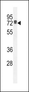 LRRC40 Antibody - LRC40 Antibody western blot of HepG2 cell line lysates (35 ug/lane). The LRC40 antibody detected the LRC40 protein (arrow).