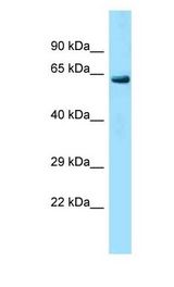 LRRC40 Antibody - LRRC40 antibody Western Blot of Mouse Liver. Antibody dilution: 1 ug/ml.  This image was taken for the unconjugated form of this product. Other forms have not been tested.