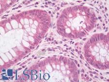 LRRC40 Antibody - Human Colon: Formalin-Fixed, Paraffin-Embedded (FFPE).  This image was taken for the unconjugated form of this product. Other forms have not been tested.