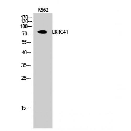 LRRC41 Antibody - Western blot of LRRC41 antibody