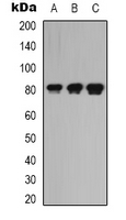 LRRC41 Antibody - Western blot analysis of LRRC41 expression in K562 (A); rat kidney (B); rat heart (C) whole cell lysates.