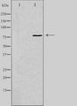 LRRC41 Antibody - Western blot analysis of extracts of rat kidney/rat heart cells using LRRC41 antibody. The lane on the left is treated with the antigen-specific peptide.