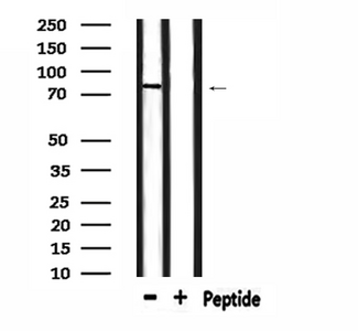 LRRC41 Antibody - Western blot analysis of extracts of mouse brain tissue using LRRC41 antibody.
