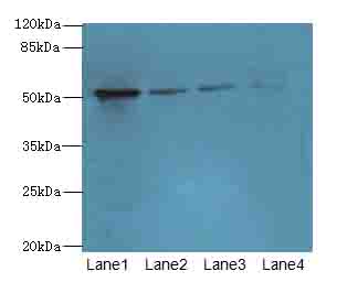 LRRC42 Antibody - Western blot. All lanes: LRRC42 antibody at 10 ug/ml. Lane 1: MCF7 whole cell lysate. Lane 2: A549 whole cell lysate. Lane 3: HCT116 whole cell lysate. Lane 4: Colo320 whole cell lysate. Secondary Goat polyclonal to Rabbit IgG at 1:10000 dilution. Predicted band size: 49 kDa. Observed band size: 49 kDa.