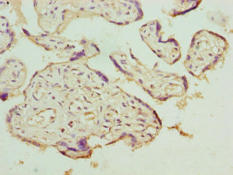 LRRC42 Antibody - Immunohistochemistry of paraffin-embedded human placenta tissue using LRRC42 Antibody at dilution of 1:100