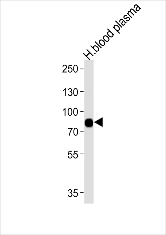 LRRC45 Antibody - Western blot of lysates from human blood plasma tissue (from left to right),using LRRC45 Antibody. Antibody was diluted at 1:1000 at each lane. A goat anti-rabbit IgG H&L (HRP) at 1:5000 dilution was used as the secondary antibody.Lysates at 35ug per lane.