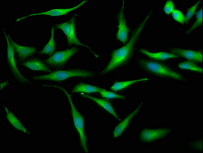 LRRC45 Antibody - Immunofluorescence staining of Hela cells at a dilution of 1:133, counter-stained with DAPI. The cells were fixed in 4% formaldehyde, permeabilized using 0.2% Triton X-100 and blocked in 10% normal Goat Serum. The cells were then incubated with the antibody overnight at 4 °C.The secondary antibody was Alexa Fluor 488-congugated AffiniPure Goat Anti-Rabbit IgG (H+L) .