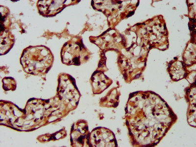 LRRC45 Antibody - Immunohistochemistry image at a dilution of 1:400 and staining in paraffin-embedded human placenta tissue performed on a Leica BondTM system. After dewaxing and hydration, antigen retrieval was mediated by high pressure in a citrate buffer (pH 6.0) . Section was blocked with 10% normal goat serum 30min at RT. Then primary antibody (1% BSA) was incubated at 4 °C overnight. The primary is detected by a biotinylated secondary antibody and visualized using an HRP conjugated SP system.