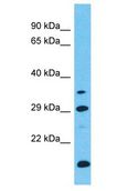 LRRC46 Antibody - LRRC46 antibody Western Blot of ACHN. Antibody dilution: 1 ug/ml.  This image was taken for the unconjugated form of this product. Other forms have not been tested.