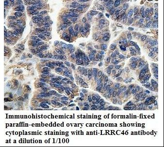 LRRC46 Antibody