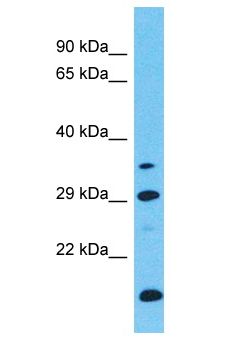 LRRC46 Antibody - LRRC46 antibody Western Blot of ACHN. Antibody dilution: 1 ug/ml.  This image was taken for the unconjugated form of this product. Other forms have not been tested.