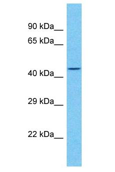LRRC48 Antibody - LRRC48 antibody Western Blot of ACHN. Antibody dilution: 1 ug/ml.  This image was taken for the unconjugated form of this product. Other forms have not been tested.