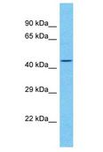 LRRC48 Antibody - LRRC48 antibody Western Blot of ACHN. Antibody dilution: 1 ug/ml.  This image was taken for the unconjugated form of this product. Other forms have not been tested.