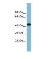 LRRC49 Antibody - Western blot of Human Fetal Heart. LRRC49 antibody dilution 1.0 ug/ml.  This image was taken for the unconjugated form of this product. Other forms have not been tested.