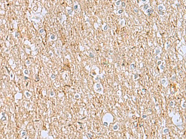 LRRC49 Antibody - Immunohistochemistry of paraffin-embedded Human brain tissue  using LRRC49 Polyclonal Antibody at dilution of 1:40(×200)