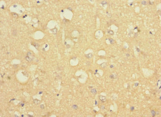 LRRC4C Antibody - Immunohistochemistry of paraffin-embedded human brain tissue using LRRC4C Antibody at dilution of 1:100