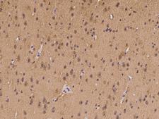 LRRC4C Antibody - Immunochemical staining of human LRRC4C in human brain with rabbit polyclonal antibody at 1:100 dilution, formalin-fixed paraffin embedded sections.