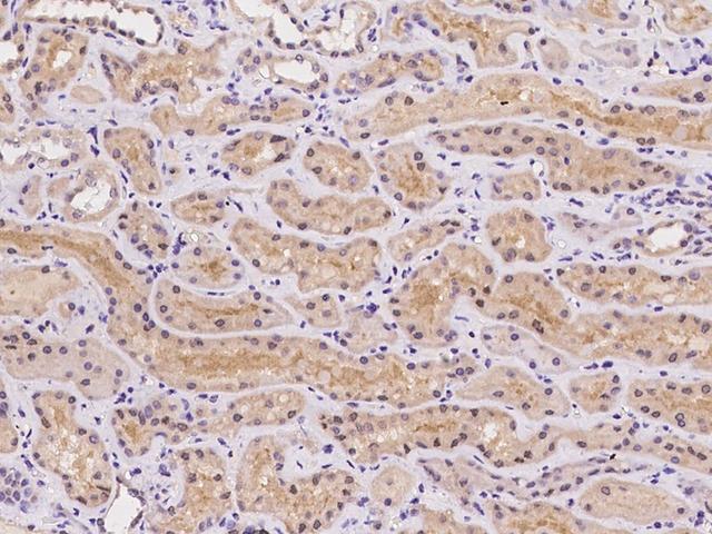 LRRC4C Antibody - Immunochemical staining of human LRRC4C in human kidney with rabbit polyclonal antibody at 1:100 dilution, formalin-fixed paraffin embedded sections.
