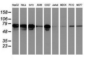LRRC50 Antibody - Western blot of extracts (35ug) from 9 different cell lines by using anti-LRRC50 monoclonal antibody.