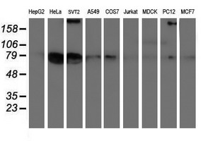 LRRC50 Antibody - Western blot of extracts (35ug) from 9 different cell lines by using anti-LRRC50 monoclonal antibody (HepG2: human; HeLa: human; SVT2: mouse; A549: human; COS7: monkey; Jurkat: human; MDCK: canine; PC12: rat; MCF7: human).