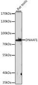 LRRC50 Antibody - Western blot analysis of extracts of rat testis using DNAAF1 Polyclonal Antibody at dilution of 1:1000.