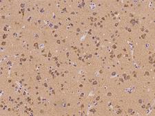 LRRC56 Antibody - Immunochemical staining of human LRRC56 in human brain with rabbit polyclonal antibody at 1:500 dilution, formalin-fixed paraffin embedded sections.