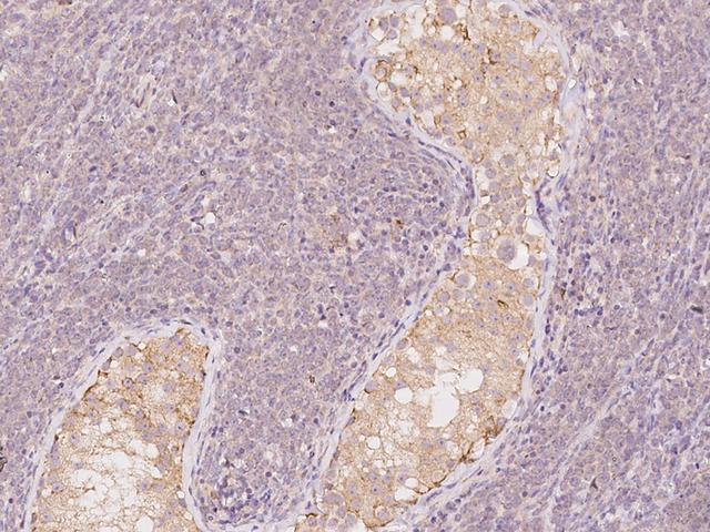 LRRC56 Antibody - Immunochemical staining of human LRRC56 in human testis with rabbit polyclonal antibody at 1:500 dilution, formalin-fixed paraffin embedded sections.