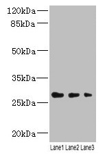 LRRC57 Antibody - Western blot All lanes: LRRC57 antibody at 4µg/ml Lane 1: Mouse liver tissue Lane 2: Mouse kidney tissue Lane 3: Mouse lung tissue Secondary Goat polyclonal to rabbit IgG at 1/10000 dilution Predicted band size: 27 kDa Observed band size: 27 kDa