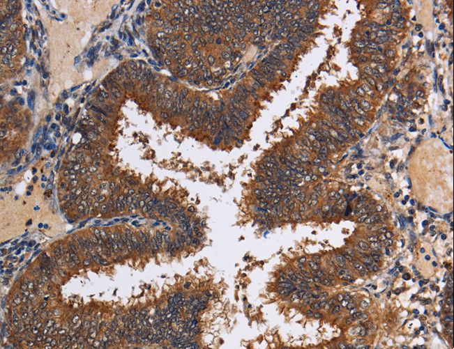 LRRC57 Antibody - Immunohistochemistry of paraffin-embedded Human tonsil using LRRC57 Polyclonal Antibody at dilution of 1:40.